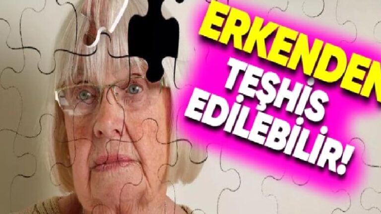 Alzheimer’ın Semptomlar Ortaya Çıkmadan Bile Önce Tespit Edilmesini Sağlayacak Usul Keşfedildi