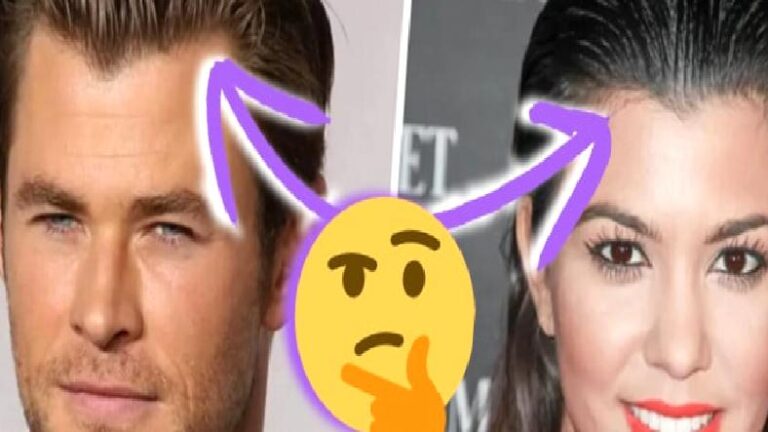 Erkeklerin Saç Çizgisi Neden Bariz Şekilde Bayanlardan Daha Farklı? Kabul Edelim, Bayanlar Daha Şanslı!