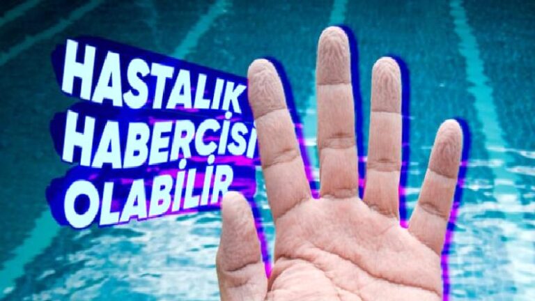 Uzun Süre Suda Kaldığımızda Neden Yalnızca El ve Ayaklarımız Buruşur?