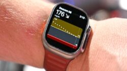 Apple Watch’larla Şeker Takibi Yakında Gelebilir: Dexcom G7 Apple Watch’a Bağlanabilecek