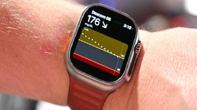 Apple Watch’larla Şeker Takibi Yakında Gelebilir: Dexcom G7 Apple Watch’a Bağlanabilecek