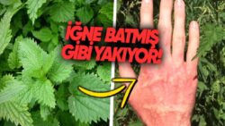 Isırgan Otu Neden Cildimizi Güya İğne Batmışçasına Yakar?
