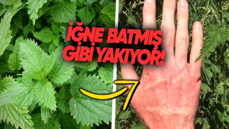 Isırgan Otu Neden Cildimizi Güya İğne Batmışçasına Yakar?
