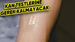Kandaki Şeker Oranını Ölçebilen “Yara Bandı” Aygıt Geliştirildi
