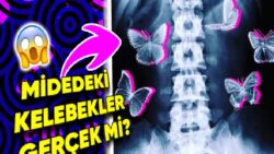 Sıkça Kullandığımız “Birinden Elektrik Almak” yahut “Midemde Kelebekler Uçuşuyor” Tabirleri Fizyolojik Açıdan Gerçek Olabilir mi?