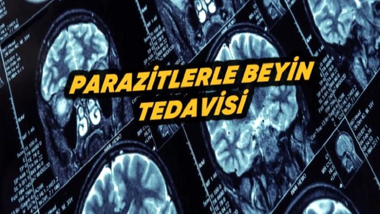 Bilim İnsanlarından Direkt Beyne İlaç Vermek İçin Korkutan Sistem: Parazit!