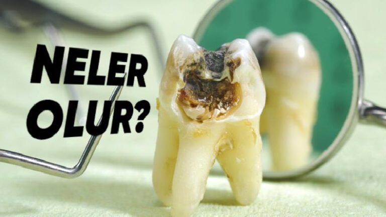 Dişlerinizi Fırçalamayı Apansız Bırakırsanız Neler Olur? Çürümekten Daha Fazlası Var…