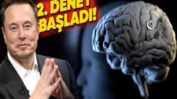 Elon Musk, Neuralink’in İkinci Kere Bir İnsanın Beynine Çip Yerleştirdiğini Açıkladı!