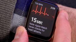 Apple Watch, EKG özelliği sayesinde gebe bir bayanı kurtardı!