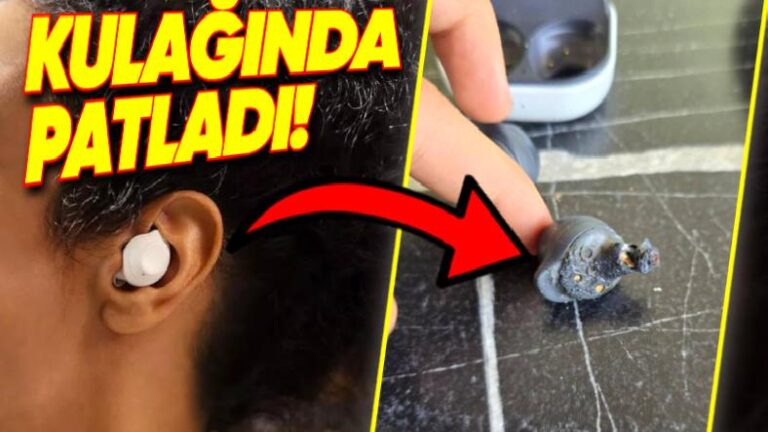 Bir Türk Kullanıcı, Samsung Galaxy Buds FE’nin Kulağında Patladığını ve Kalıcı İşitme Kaybına Neden Olduğunu İddia Etti