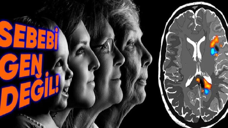 Bilim İnsanlarını Şaşkına Çeviren, Dünyanın En Genç Alzheimer Olan İnsanı Nasıl 19 Yaşında Bu Hastalığa Yakalandı?