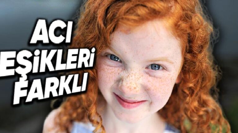 Dünya Nüfusunun Azınlığını Oluşturan Kızıl Saçlı İnsanların Acı Eşiği Bizimkinden Çok Farklı: Pekala Nedeni Ne?