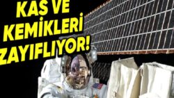 Uzayda Bir Yıldan Fazla Kalan Astronotların Döndüğünde Uğraştığı Sağlık Sorunlarını Öğrenince Bu İşin Zorluğunu Daha İyi Anlayacaksınız!