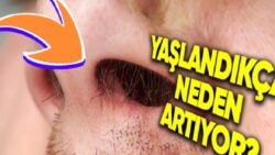 Çocukken Varlığı Belli Bile Olmayan Burun Kılları Yaşlandıkça Neden Çoğalmaya Başlıyor?