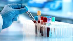 Yeni bir tıbbi test, tıp dünyasında büyük ihtilale yol açabilir