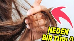 Kimi İnsanların Saçları ve Tırnakları Çok Süratli Uzarken Kimilerinin Neden Bir Türlü Uzamaz?