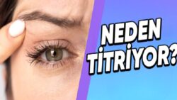 Dozunda Bilim #7: Göz Kapağı Seğirmesinin Gerisinde Hangi Sebepler Var? Durdurmak Mümkün Değil!