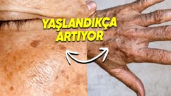 Güneş Kremlerini Boşa mı Kullanıyoruz?: Yaşlandıkça Cildimizde Oluşan Koyu Lekelerin Sebebini Açıklıyoruz