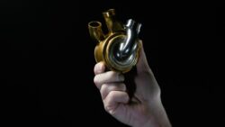 Yapay kalp takılan adamdan “100 gün mucizesi”