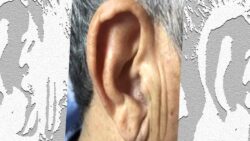 Kulak göğsünüzde bu sıra dışı kıvrım varsa, bu yazıyı kesinlikle okuyun