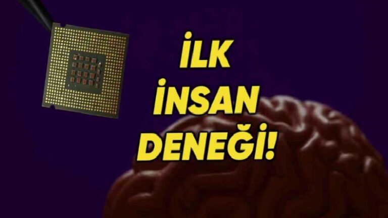 Tarihi Deneme Gerçekleşti: Bir Beyin İmplantı Şirketi İnsan Beynine İlk Defa Çip Yerleştirdi