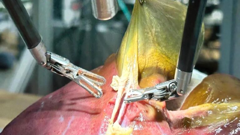Doktorlara kötü haber: Bir robot, insan gibi ameliyat yapmayı başardı!