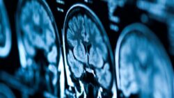 Zihnindeki sesler hayatını kurtardı: Tıp tarihinin en gizemli teşhis hikayesi