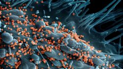 Lujo virüsü: %80 ölüm oranıyla gelen sessiz tehlike