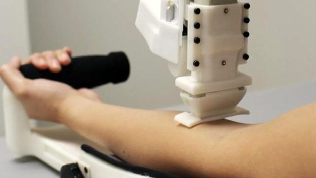 Kan Alma İşlemleri Yakında Robotlara Emanet Edilecek: Peki Ne Kadar Güvenilir?