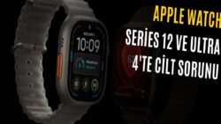 Apple Watch Kullanıcıları Tedirgin: Cilt Tahrişine Neden Oluyor